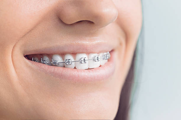 Trusted Forestville, CA  Holistic Dental Services Experts
